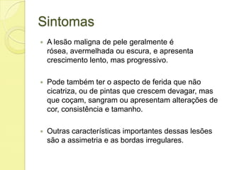 Sintomas
 A lesão maligna de pele geralmente é
rósea, avermelhada ou escura, e apresenta
crescimento lento, mas progressivo.
 Pode também ter o aspecto de ferida que não
cicatriza, ou de pintas que crescem devagar, mas
que coçam, sangram ou apresentam alterações de
cor, consistência e tamanho.
 Outras características importantes dessas lesões
são a assimetria e as bordas irregulares.
 