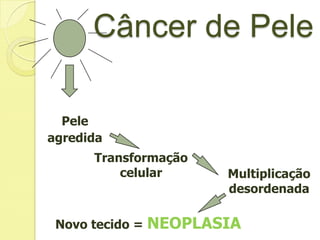 Pele
agredida
Transformação
celular Multiplicação
desordenada
Novo tecido = NEOPLASIA
Câncer de Pele
 