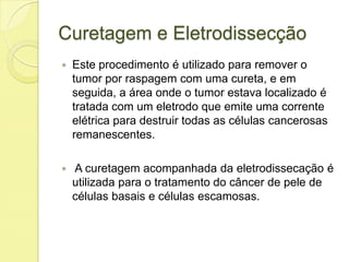 Curetagem e Eletrodissecção
 Este procedimento é utilizado para remover o
tumor por raspagem com uma cureta, e em
seguida, a área onde o tumor estava localizado é
tratada com um eletrodo que emite uma corrente
elétrica para destruir todas as células cancerosas
remanescentes.
 A curetagem acompanhada da eletrodissecação é
utilizada para o tratamento do câncer de pele de
células basais e células escamosas.
 