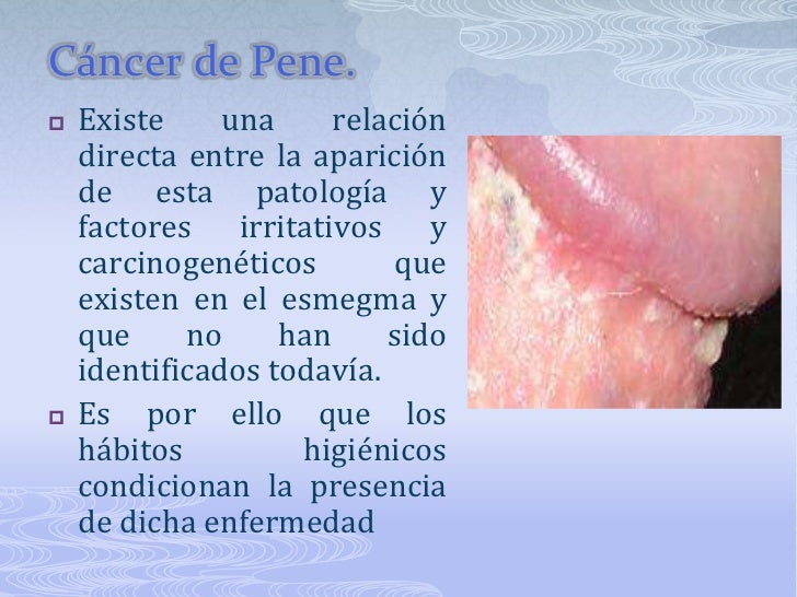 La muchacha habla que a él el pequeño miembro