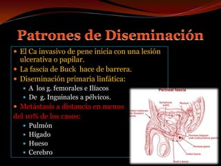 Patrones de DiseminaciónEl Ca invasivo de pene inicia con una lesión ulcerativa o papilar.La fascia de Buck  hace de barrera.Diseminación primaria linfática:A  los g. femorales e IlíacosDe  g. Inguinales a pélvicos.Metástasis a distancia en menos del 10% de los casos:Pulmón HígadoHuesoCerebro  