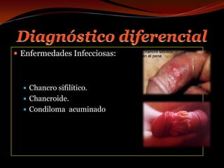 Diagnóstico diferencialEnfermedades Infecciosas:Chancro sifilítico.Chancroide.Condiloma  acuminado