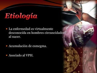EtiologíaLa enfermedad es virtualmente desconocida en hombres circuncidados al nacer.Acumulación de esmegma.Asociado al VPH.