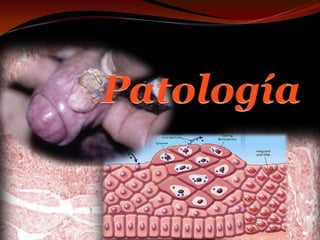 Patología