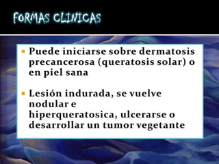 Cáncer Cutaneo