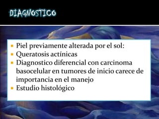 Cáncer Cutaneo