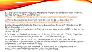 6. Acta Odontológica Venezuela. Melanoma maligno en el labio inferior. [Internet].
[Citado Junio 27, 2014] Disponible en:
http://www.actaodontologica.com/ediciones/2003/2/images/89/image3.jpg
7.Wikimedia. Basalioma. [Internet]. [Citado Junio 27, 2014] Disponible en:
http://upload.wikimedia.org/wikipedia/commons/9/99/Basalioma.jpg
8.Udl.es: Universitat de Lleida. Carcinoma basocelular. [Internet]. [Citado Junio 27,
2014] Disponible en:
http://web.udl.es/usuaris/dermatol/Atlasweb/carc_bas_nodular/600/carcinoma_bas
ocelular36.JPG
9.Elsol.com.bo: Diario El Sol. Melanoma [Internet]. [Citado Junio 27,2014] Disponible
en: http://elsol.com.bo/images/Noticias/11-6-6/Melanoma1.jpg
10.Estarguapas.com. Captura de pantalla [Internet]. [Citado Junio 27,2014]
Disponible en: http://www.estarguapas.com/wp-content/uploads/2011/08/captura-
de-pantalla-2011-08-05-a-las-093952.jpg
11.Naturalmenteguapa.net. [Internet]. [Citado Junio 27, 2014] Disponible en:
http://www.naturalmenteguapa.net/img/cms/solnat.jpg
 