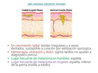  En crecimiento radial: bordes irregulares y a veces
dentados, susceptible a curación por extirpación quirúrgica.
 Hemorragia, ulceración y dolor: signos tardíos no ayudan a
diagnóstico precoz.
 Lugar frecuente de melanoma en hombres: espalda.
 Lugar frecuente de melanoma en mujeres: espalda, inferior
de la pierna (rodilla a tobillo).
 
