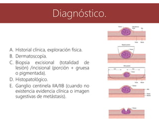 A. Historial clínica, exploración física.
B. Dermatoscopía.
C. Biopsia excisional (totalidad de
lesión) /incisional (porción + gruesa
o pigmentada).
D. Histopatológico.
E. Ganglio centinela IIA/IIB (cuando no
existencia evidencia clínica o imagen
sugestivas de metástasis).
Diagnóstico.
 