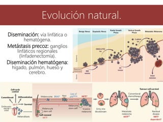 Diseminación: vía linfática o
hematógena.
Metástasis precoz: ganglios
linfáticos regionales
(linfadenectomía).
Diseminación hematógena:
hígado, pulmón, hueso y
cerebro.
Evolución natural.
 