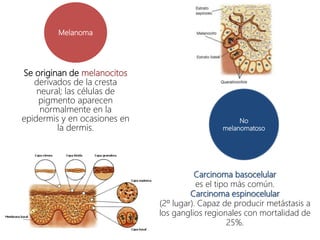 Se originan de melanocitos
derivados de la cresta
neural; las células de
pigmento aparecen
normalmente en la
epidermis y en ocasiones en
la dermis.
No
melanomatoso
Carcinoma basocelular
es el tipo más común.
Carcinoma espinocelular
(2º lugar). Capaz de producir metástasis a
los ganglios regionales con mortalidad de
25%.
Melanoma
 