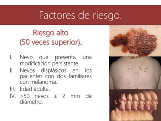 Factores de riesgo.
Riesgo alto
(50 veces superior).
I. Nevo que presenta una
modificación persistente.
II. Nevos displásicos en los
pacientes con dos familiares
con melanoma.
III. Edad adulta.
IV. >50 nevos ≥ 2 mm de
diámetro.
 
