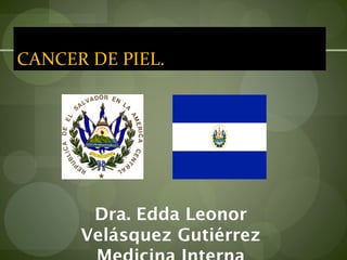 CANCER DE PIEL.




       Dra. Edda Leonor
      Velásquez Gutiérrez
 