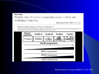 British Journal of  Cancer (2004) 91, 1633-1638 