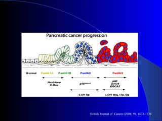 British Journal of  Cancer (2004) 91, 1633-1638 