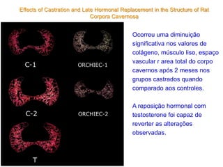 Effects of Castration and Late Hormonal Replacement in the Structure of Rat
Corpora Cavernosa
Ocorreu uma diminuição
significativa nos valores de
colágeno, músculo liso, espaço
vascular r area total do corpo
cavernos após 2 meses nos
grupos castrados quando
comparado aos controles.
A reposição hormonal com
testosterone foi capaz de
reverter as alterações
observadas.
 