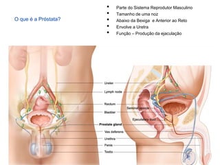 • Parte do Sistema Reprodutor Masculino
• Tamanho de uma noz
• Abaixo da Bexiga e Anterior ao Reto
• Envolve a Uretra
• Função – Produção da ejaculação
O que é a Próstata?
 