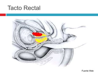 Tacto Rectal




               Fuente Web
 