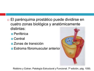    El parénquima prostático puede dividirse en
    cuatro zonas biológica y anatómicamente
    distintas:
     Periférica

     Central

     Zonas de transición
     Estroma fibromuscular anterior




     Robbins y Cotran. Patología Estructural y Funcional. 7ª edición, pág. 1050.
 
