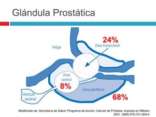 Glándula Prostática

                                                            24%




                              8%
                                                                   68%
 Modificado de: Secretaría de Salud. Programa de Acción: Cáncer de Próstata. Impreso en México
                                                                    2001. ISBN 970-721-004-4
 