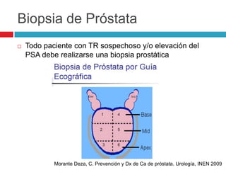 Biopsia de Próstata
   Todo paciente con TR sospechoso y/o elevación del
    PSA debe realizarse una biopsia prostática




            Morante Deza, C. Prevención y Dx de Ca de próstata. Urología, INEN 2009
 