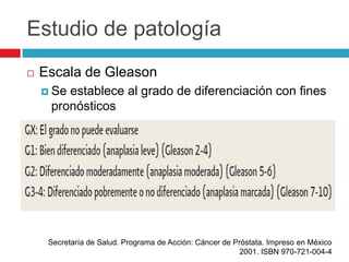 Estudio de patología
   Escala de Gleason
     Seestablece al grado de diferenciación con fines
     pronósticos




     Secretaría de Salud. Programa de Acción: Cáncer de Próstata. Impreso en México
                                                         2001. ISBN 970-721-004-4
 