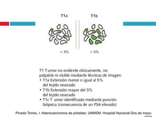 Pinedo Torres, I. Adenocarcinoma de próstata. UNMSM. Hospital Nacional Dos de mayo.
 