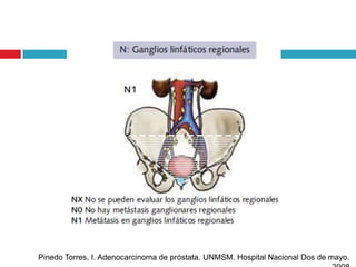 Pinedo Torres, I. Adenocarcinoma de próstata. UNMSM. Hospital Nacional Dos de mayo.
 