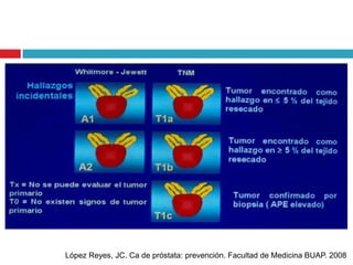 López Reyes, JC. Ca de próstata: prevención. Facultad de Medicina BUAP. 2008
 