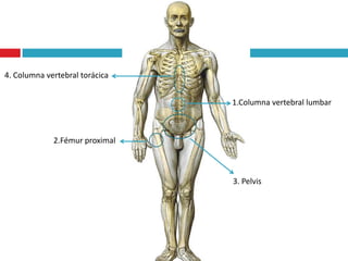 4. Columna vertebral torácica


                                1.Columna vertebral lumbar



             2.Fémur proximal



                                3. Pelvis
 