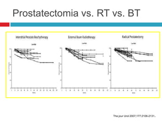 Prostatectomia vs. RT vs. BT




                      The jour Urol 2007;177:2106-2131.
 