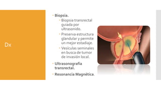 Dx
 Biopsia.
 Biopsia transrectal
guiada por
ultrasonido.
 Preserva estructura
glandular y permite
un mejor estadiaje.
 Vesículas seminales
en busca de tumor
de invasión local.
 Ultrasonografía
transrectal.
 Resonancia Magnética.
 