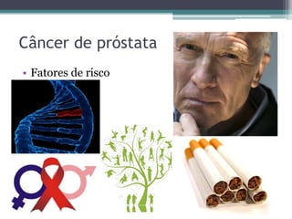 Câncer de próstata 
• Fatores de risco 
 