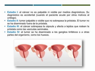  Estadio I: el cáncer no es palpable ni visible por medios diagnósticos. Su 
diagnóstico es accidental (cuando el paciente acude por otros motivos al 
urólogo). 
 Estadio II: tumor palpable o visible que no sobrepasa la próstata. El tumor no 
se ha diseminado fuera de la próstata. 
 Estadio III: el cáncer sobrepasa la cápsula y afecta a tejidos que rodean la 
próstata como las vesículas seminales. 
 Estadio IV: el tumor se ha diseminado a los ganglios linfáticos o a otras 
partes del organismo, como los huesos. 
 