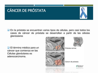CÁNCER DE PRÓSTATA 
 En la próstata se encuentran varios tipos de células, pero casi todos los 
casos de cáncer de próstata se desarrollan a partir de las células 
glandulares 
 El término médico para un 
cáncer que comienza en las 
Células glandulares es 
adenocarcinoma. 
 