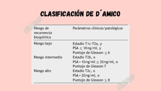 Clasificación de D´Amico
 