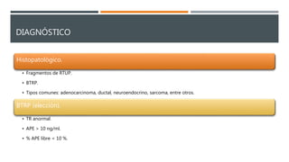 DIAGNÓSTICO
Histopatológico.
• Fragmentos de RTUP.
• BTRP.
• Tipos comunes: adenocarcinoma, ductal, neuroendocrino, sarcoma, entre otros.
BTRP (elección).
• TR anormal.
• APE > 10 ng/ml.
• % APE libre < 10 %.
 
