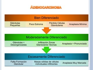 Escasamente Diferenciado
Falta Formación
Glandular
Masas sólidas de células
individuales infiltrantes
Anaplasia Muy Marcada
Moderadamente Diferenciado
Glándulas +
Desorganizadas
Infiltración Zonas
Glandulares Vecinas
Anaplasia + Pronunciada
Bien Diferenciado
Glándulas
Pequeñas
Poco Estroma
Pérdida Células
Glandulares
Anaplasia Mínima
 