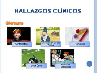 Asintomáticos
Obstrucción Cuello
Vesical
Hematuria
Dolor Óseo
Fracturas
Patológicas
 
