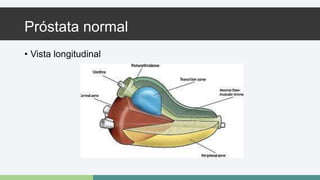 Próstata normal 
• Vista longitudinal 
 
