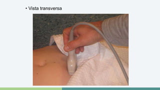 • Vista transversa 
 