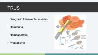 TRUS 
• Sangrado transrrectal mínimo 
• Hematuria 
• Hemospermia 
• Prostatismo 
 