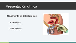 Presentación clínica 
• Usualmente es detectado por: 
• PSA ≥4ng/dL 
• DRE anormal 
 