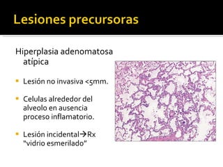 Hiperplasia adenomatosa atípica Lesión no invasiva <5mm. Celulas alrededor del alveolo en ausencia proceso inflamatorio. Lesión incidental  Rx “vidrio esmerilado” 