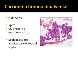 Noinvasivo <3cm Mucinoso, no mucinoso, mixto. Se debe evaluar arquitectura de todo el tejido. 