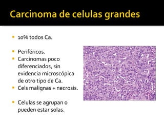 10% todos Ca. Periféricos. Carcinomas poco diferenciados, sin evidencia microscópica de otro tipo de Ca. Cels malignas + necrosis. Celulas se agrupan o pueden estar solas. 