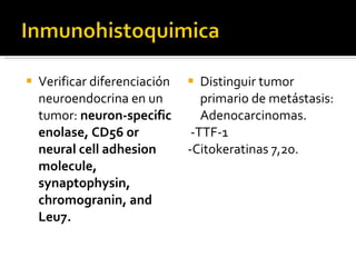 Verificar diferenciación neuroendocrina en un tumor:  neuron-specific enolase, CD56 or neural cell adhesion molecule, synaptophysin, chromogranin, and Leu7. Distinguir tumor primario de metástasis: Adenocarcinomas. -TTF-1 -Citokeratinas 7,20. 