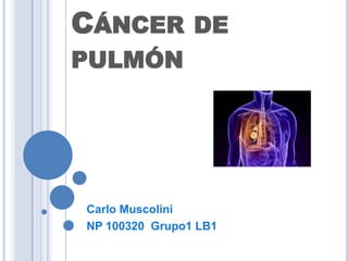 CÁNCER          DE
PULMÓN




Carlo Muscolini
NP 100320 Grupo1 LB1
 