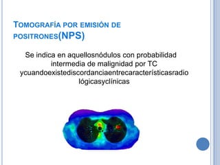 TOMOGRAFÍA POR EMISIÓN DE
POSITRONES(NPS)

  Se indica en aquellosnódulos con probabilidad
          intermedia de malignidad por TC
 ycuandoexistediscordanciaentrecaracterísticasradio
                  lógicasyclínicas
 