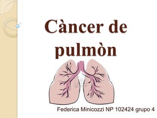 Càncer de
pulmòn
Federica Minicozzi NP 102424 grupo 4
 